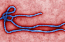 Ebola Virus - Expert Q&A