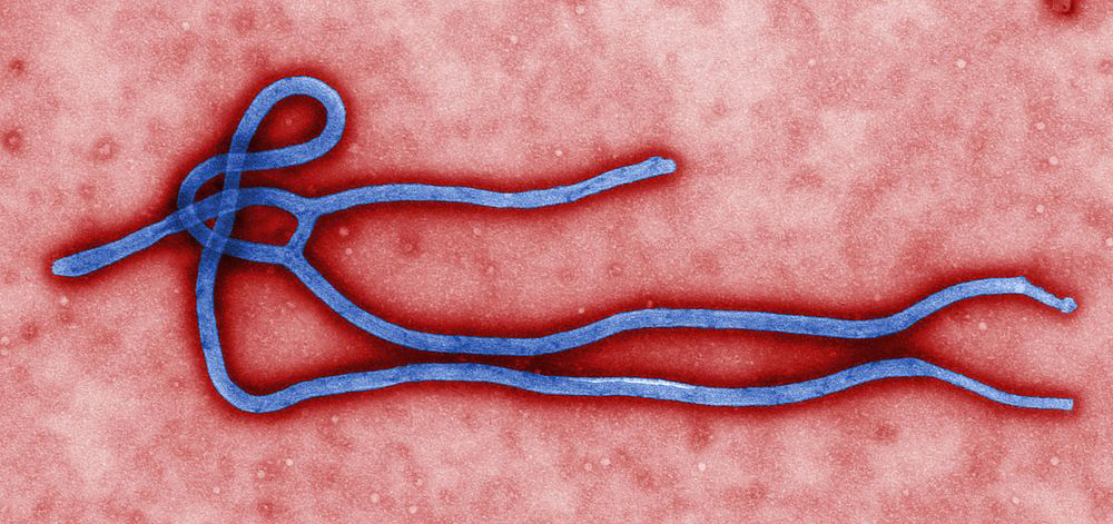 Ebola virus virion. Created by CDC microbiologist Cynthia Goldsmith, this colorized transmission electron micrograph (TEM) revealed some of the ultrastructural morphology displayed by an Ebola virus virion.