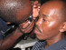 Learning basic fundoscopy